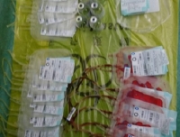 我院妇产科、麻醉科和手术室默契配合全力抢救产后大出血病人获得成功
