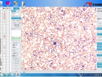 检验科通过骨髓细胞远程分析系统实现网络化诊断会诊