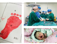 最高龄妈妈圆梦华西二院产科:断离17年的母子缘再续