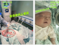 精湛医术联合精细护理，为我院最小体重超早产儿保驾护航——四川大学华西第二医院新生儿科成功救治建院以来最小体重超早产儿