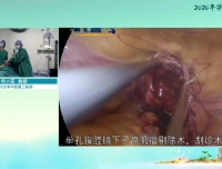 华西妇科论坛手术直播演示取得圆满成功