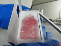 【红星新闻】在-196℃温度下“沉睡”了14年 这份脐带血成功复苏去救命