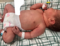 检验科血库协助救治一例罕见抗-s血型抗体阳性产妇