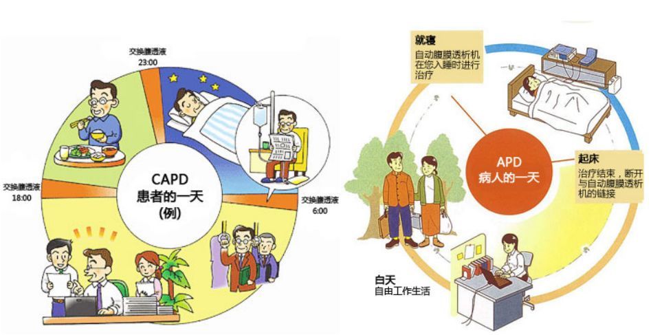 自動腹膜透析治療模式