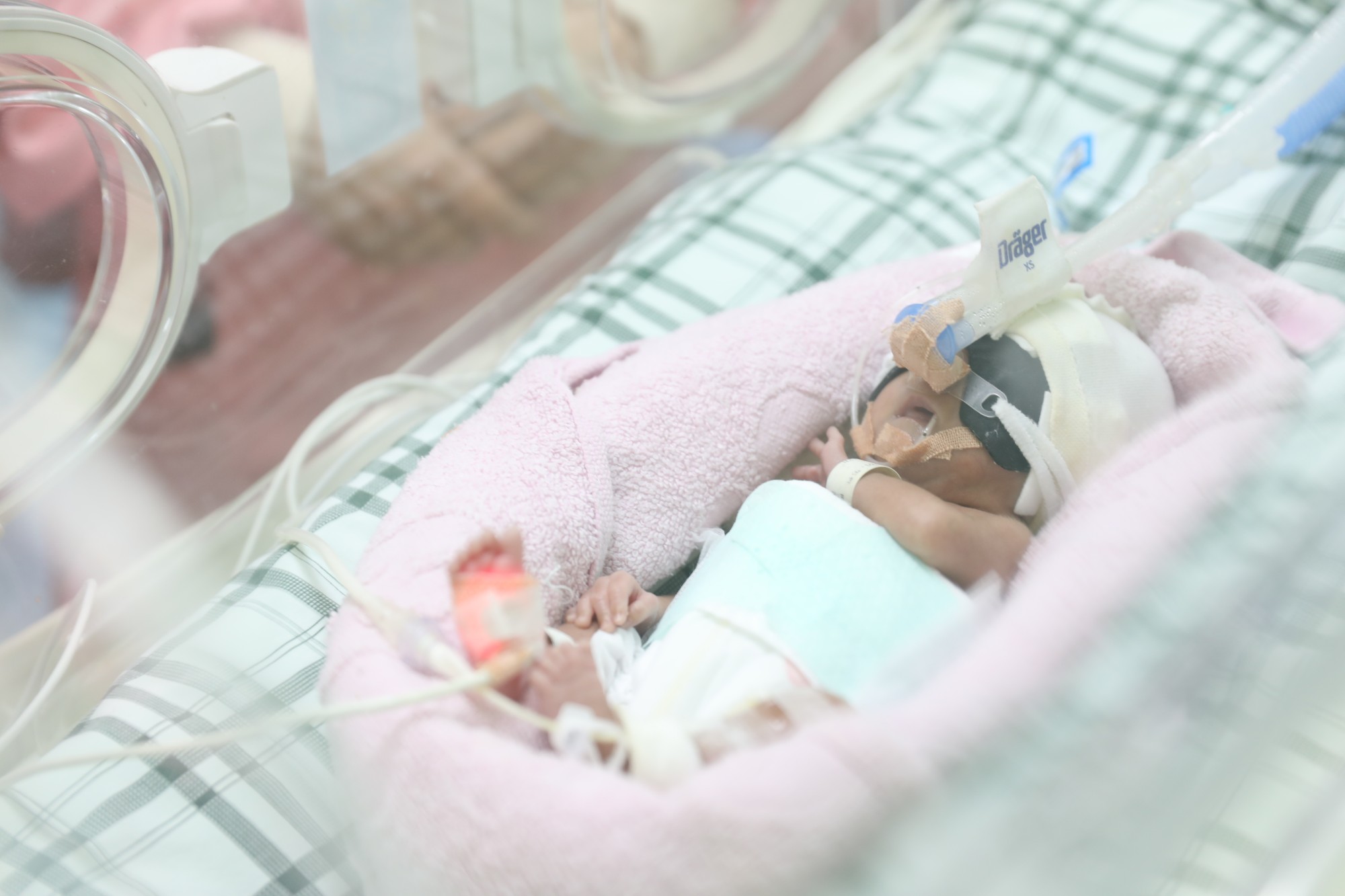 新生儿PICC置管术，为早产宝宝生命护航-长治医学院附属和济医院
